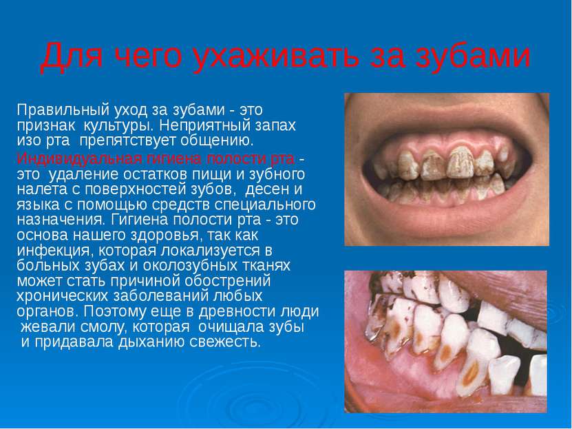 Для чего ухаживать за зубами Правильный уход за зубами - это признак  культур...