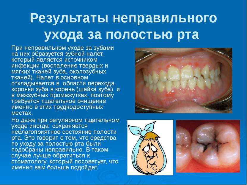 Результаты неправильного ухода за полостью рта При неправильном уходе за зуба...