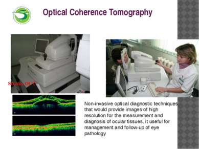 Optical Coherence Tomography Stratus OCT Non-invasive optical diagnostic tech...