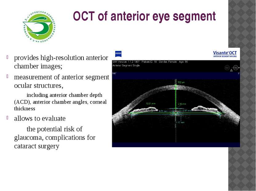 OCT of anterior eye segment provides high-resolution anterior chamber images;...