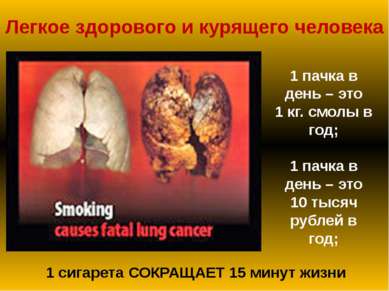 Легкое здорового и курящего человека 1 сигарета СОКРАЩАЕТ 15 минут жизни 1 па...