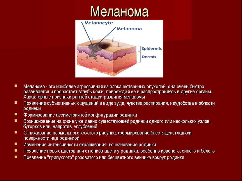 Меланома Меланома - это наиболее агрессивная из злокачественных опухолей, она...