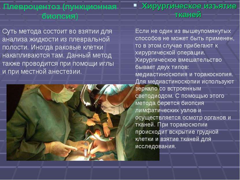Хирургическое изъятие тканей Плевроцентоз (пункционная биопсия) Суть метода с...