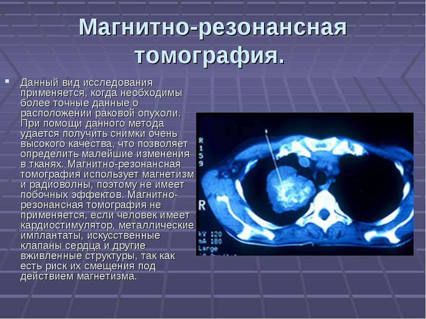 Магнитно-резонансная томография. Данный вид исследования применяется, когда н...