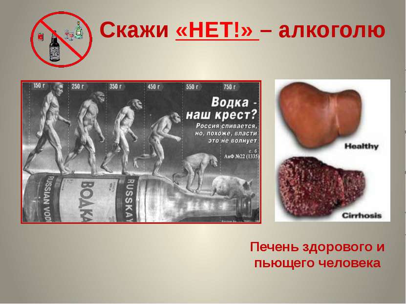Скажи «НЕТ!» – алкоголю Печень здорового и пьющего человека Данилова О.А. , п...