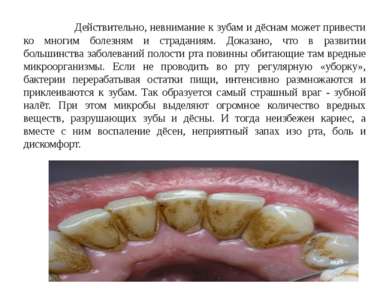 Действительно, невнимание к зубам и дёснам может привести ко многим болезням ...