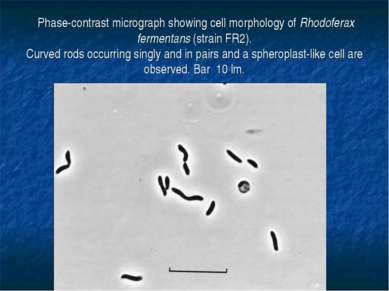 Phase-contrast micrograph showing cell morphology of Rhodoferax fermentans (s...