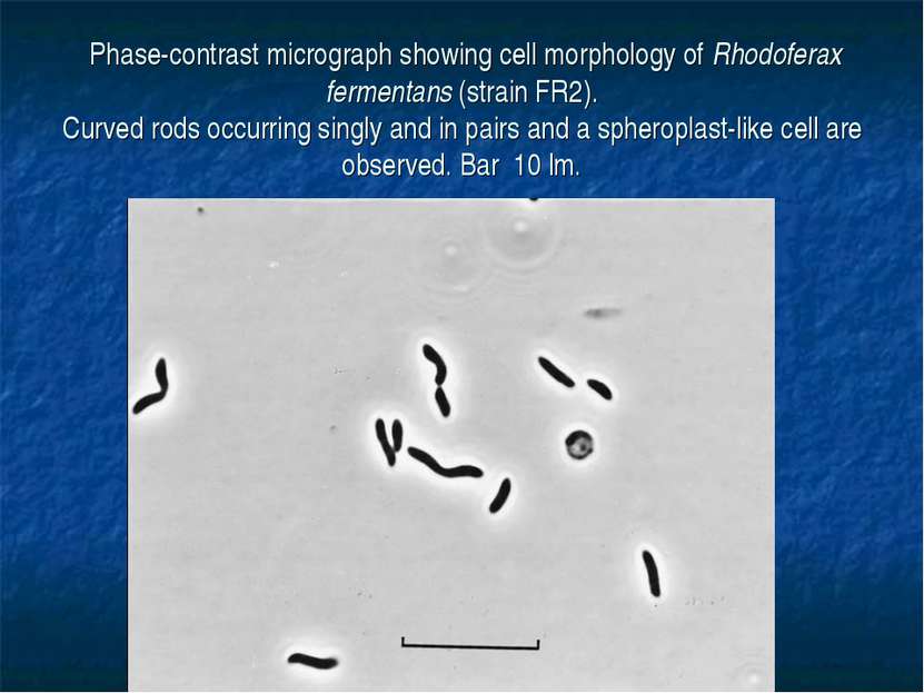 Phase-contrast micrograph showing cell morphology of Rhodoferax fermentans (s...