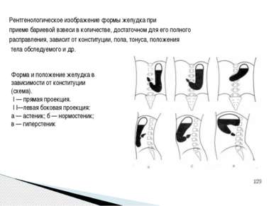 Рентгенологическое изображение формы желудка при приеме бариевой взвеси в кол...