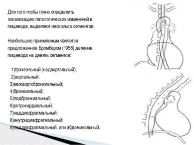 Для того чтобы точно определить локализацию патологических изменений в пищево...