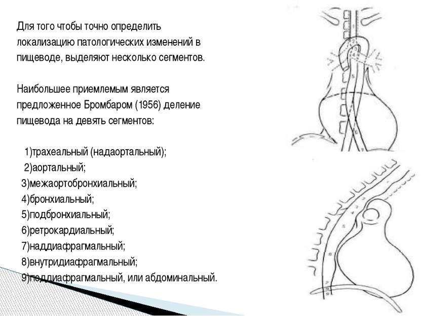 Для того чтобы точно определить локализацию патологических изменений в пищево...