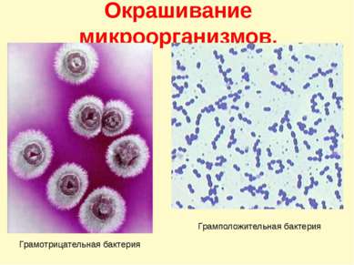 Окрашивание микроорганизмов. Грамотрицательная бактерия Грамположительная бак...