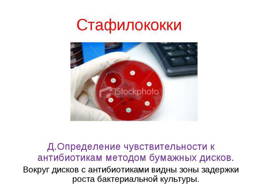 Стафилококки Д.Определение чувствительности к антибиотикам методом бумажных д...