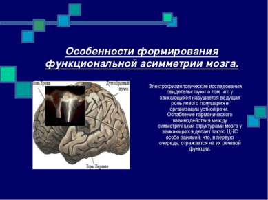 Особенности формирования функциональной асимметрии мозга. Электрофизиологичес...