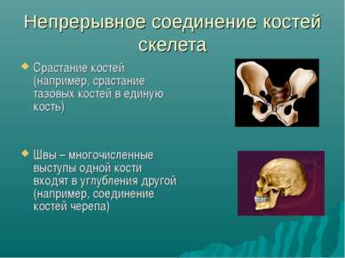 Непрерывное соединение костей скелета Срастание костей (например, срастание т...