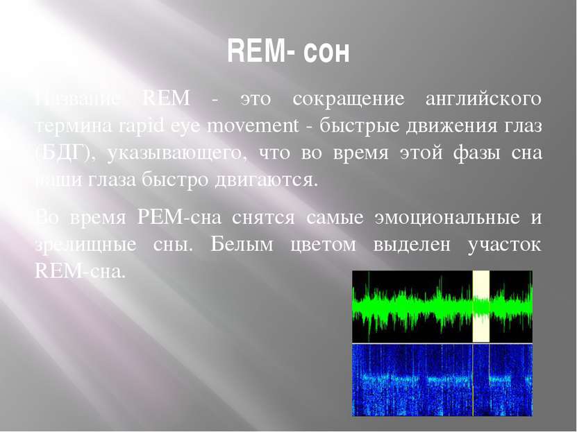 REM- сон Название REM - это сокращение английского термина rapid eye movement...
