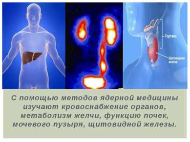 С помощью методов ядерной медицины изучают кровоснабжение органов, метаболизм...