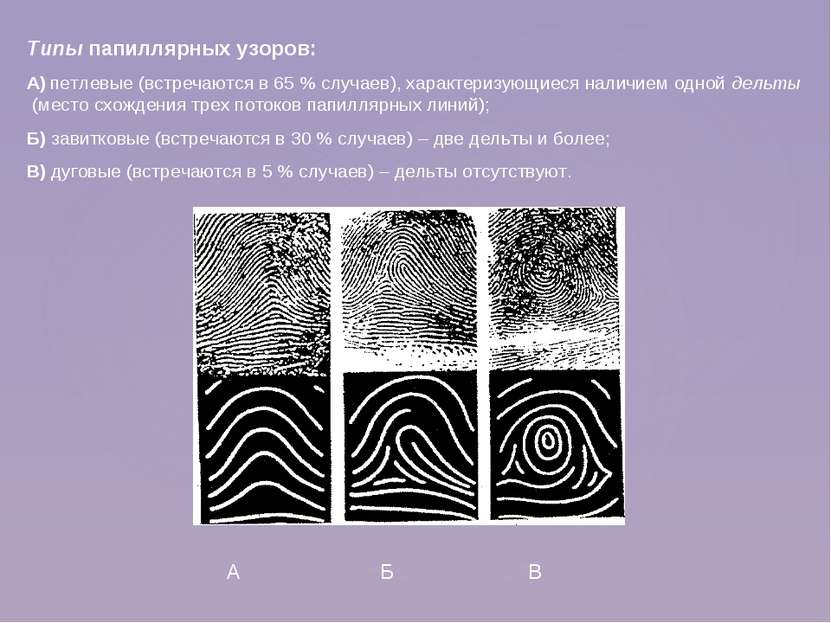 Типы папиллярных узоров: А) петлевые (встречаются в 65 % случаев), характериз...