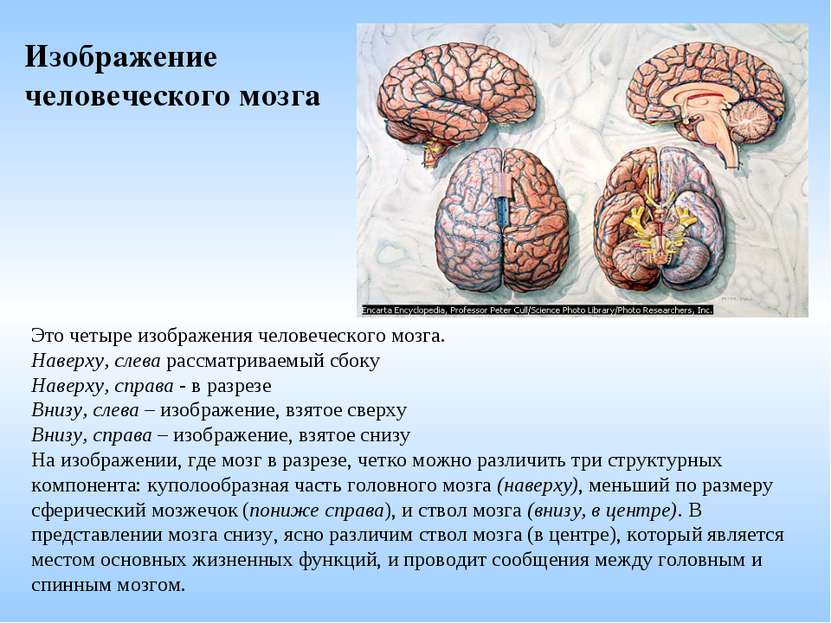 Это четыре изображения человеческого мозга. Наверху, слева рассматриваемый сб...