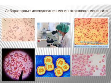 Лабораторные исследования менингококкового менингита