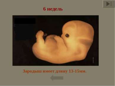 Зародыш имеет длину 13-15мм. 6 недель