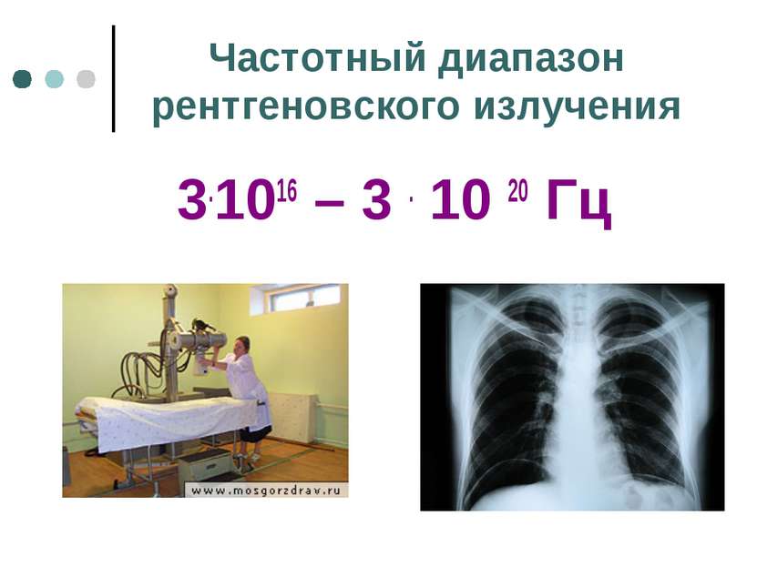 Частотный диапазон рентгеновского излучения 3.1016 – 3 . 10 20 Гц