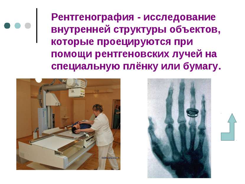 Рентгенография - исследование внутренней структуры объектов, которые проециру...