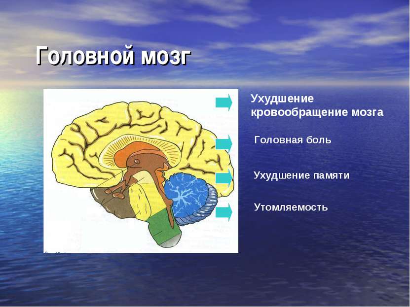 Головной мозг Ухудшение кровообращение мозга Головная боль Ухудшение памяти У...