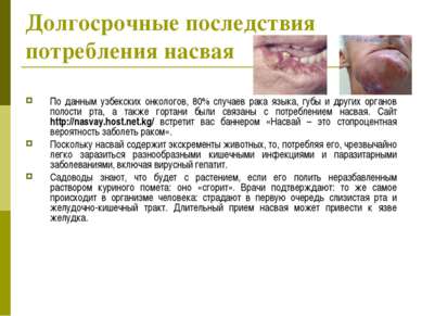 Долгосрочные последствия потребления насвая По данным узбекских онкологов, 80...
