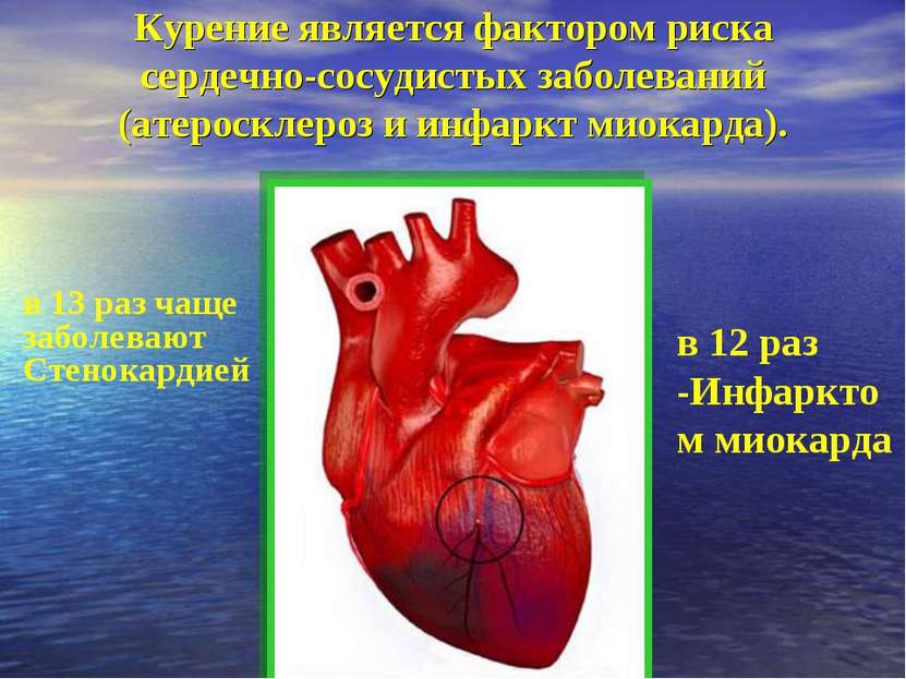 Курение является фактором риска сердечно-сосудистых заболеваний (атеросклероз...