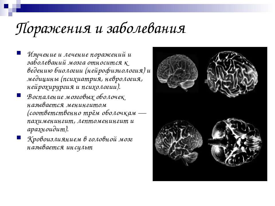 Болезни мозга названия. Лептоменингит или арахноидит презентация.
