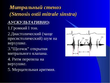 Митральный стеноз (Stenosis ostii mitrale sinstra) АУСКУЛЬТАТИВНО: 1.Громкий ...