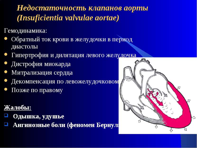 Недостаточность клапанов аорты (Insuficientia valvulae aortae) Гемодинамика: ...