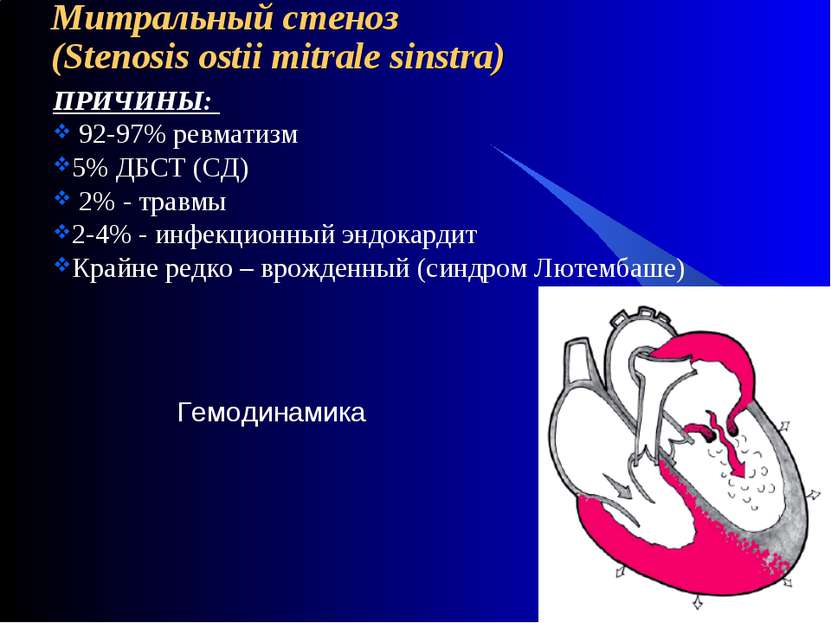 Митральный стеноз (Stenosis ostii mitrale sinstra) ПРИЧИНЫ: 92-97% ревматизм ...