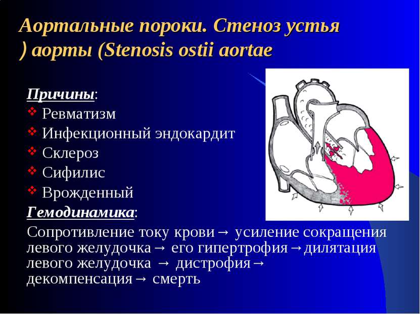 Аортальные пороки. Стеноз устья аорты (Stenosis ostii aortae ) Причины: Ревма...