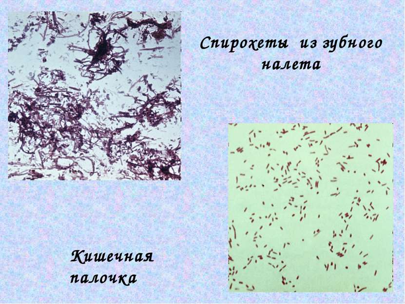 Спирохеты из зубного налета Кишечная палочка