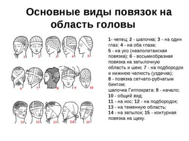    Основные виды повязок на область головы 1- чепец; 2 - шапочка; 3 - на один...