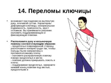 14. Переломы ключицы возникают при падении на вытянутую руку, плечевой сустав...