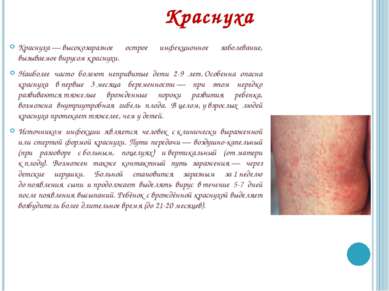 Краснуха Краснуха — высокозаразное острое инфекционное заболевание, вызываемо...