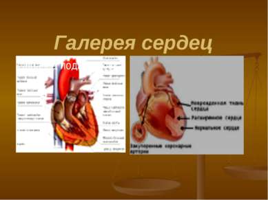 Галерея сердец