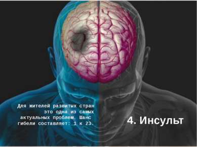 4. Инсульт Для жителей развитых стран это одна из самых актуальных проблем. Ш...