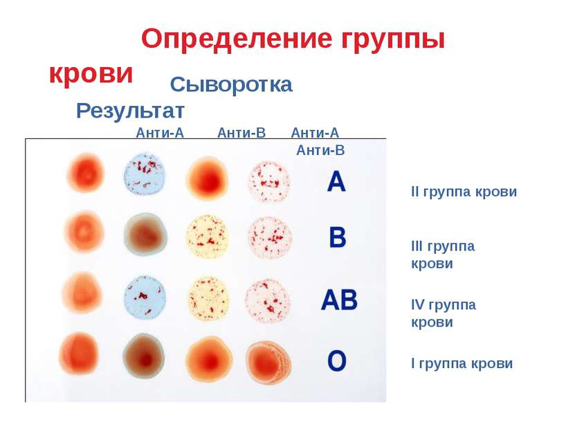 II группа крови III группа крови IV группа крови I группа крови Определение г...