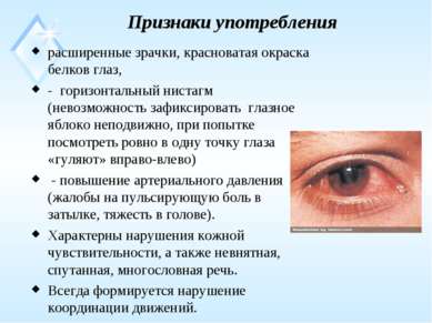 Признаки употребления расширенные зрачки, красноватая окраска белков глаз, - ...