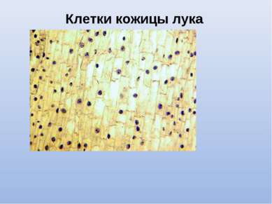 Клетки кожицы лука (микрофотография)