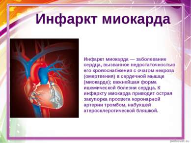 Инфаркт миокарда — заболевание сердца, вызванное недостаточностью его кровосн...