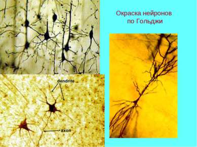 Окраска нейронов по Гольджи