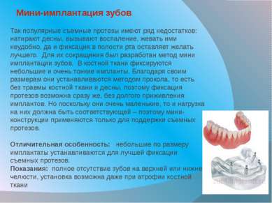 Мини-имплантация зубов Так популярные съемные протезы имеют ряд недостатков: ...