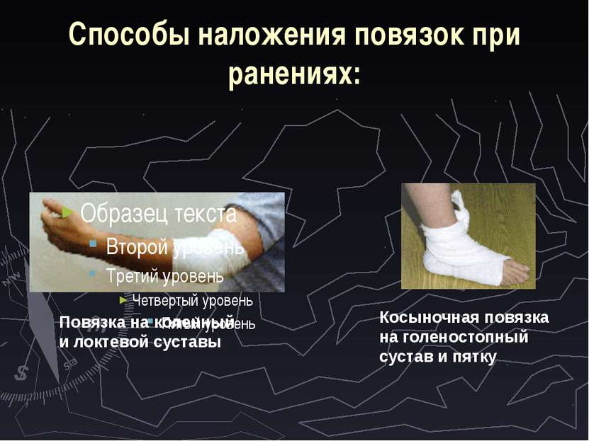 Способы наложения повязок при ранениях: Повязка на коленный и локтевой сустав...