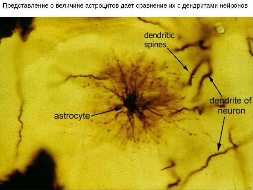 Представление о величине астроцитов дает сравнение их с дендритами нейронов