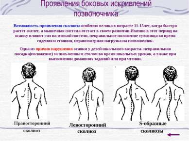 Упражнения для формирования правильной осанки Встать спиной к стене, касаясь ...